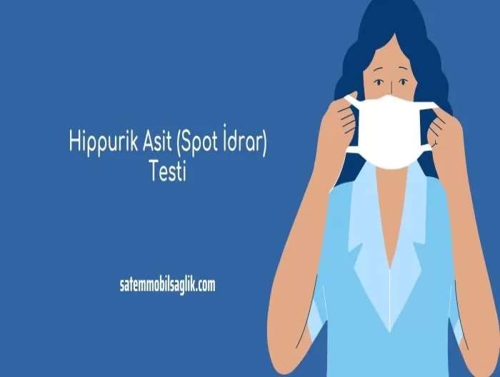 Hippurik Asit (Spot İdrar) Testi